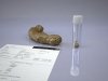 stool_sample_with_collecton_jar0f3c2db2-1ae4-4b19-83bc-f357739d20e8larger.jpg