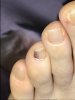 toe.jpg