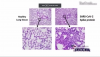 Lung tissue comparison.png